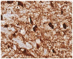 MilliporeSigma Tyrosine Hydroxylase, Mouse, Unlabeled, Clone: 10F8.2, 100&mu;L;