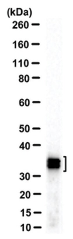 MilliporeSigma SET (I2PP2A), NT, Mouse, Unlabeled, Clone: 10E7, 100 &mu;g | Buy Online | MilliporeSigma&trade; | Fisher Scientific
