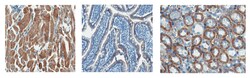 MilliporeSigma anti-SDHB Clone: 10C5.1, 100&mu;g, Unlabeled:Antibodies,