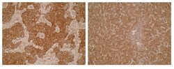 LRAT Mouse anti-Human, Mouse, Rat, Clone: M34-P1F10, MilliporeSigma 100 &mu;g | Buy Online | MilliporeSigma | Fisher Scientific
