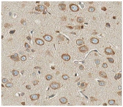 MilliporeSigma Mouse anti-VPS4A, Clone: 14B1.1, 100&mu;g:Antibodies, Monoclonal