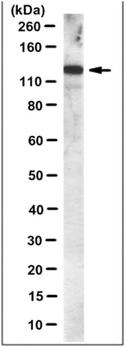 MilliporeSigma Mouse anti-PERK, Clone: 4F6.1, 100&mu;g:Antibodies, Monoclonal