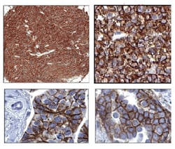 MilliporeSigma anti-ROR2 Clone: Nt2535-2835, 100&mu;g, Unlabeled:Antibodies,