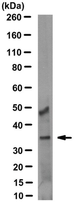 MilliporeSigma Annexin A3, Mouse, Unlabeled, Clone: 9996-1-3M1/3L7-5, 100 &mu;L | Buy Online | MilliporeSigma&trade; | Fisher Scientific
