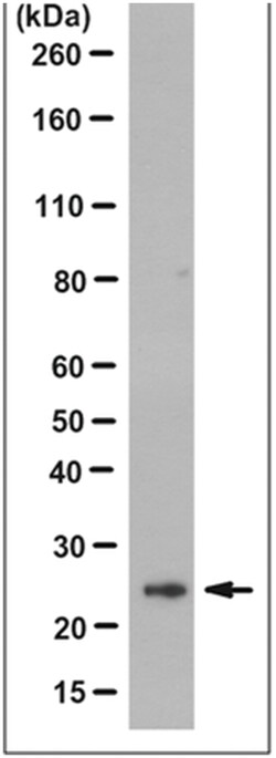 MilliporeSigma Mouse anti-HGPRT, Clone: 13H11.1, 100&mu;g:Antibodies, Monoclonal
