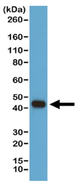MilliporeSigma Rabbit anti-beta-Actin, Clone: RM112, 100 &mu;L | Buy Online | MilliporeSigma&trade; | Fisher Scientific