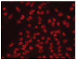 MilliporeSigma anti-2,2,7-Trimethylguanosine Clone: K121, 100 &mu;g | Buy Online | MilliporeSigma&trade; | Fisher Scientific