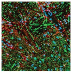MilliporeSigma anti-PhosphoDetect Neurofilament H Clone: SMI-31, 100&mu;L,