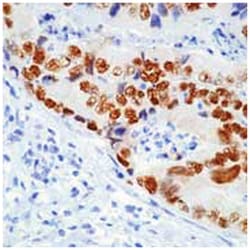 MilliporeSigma anti-p53 (Pantropic) Clone: DO-7, 100 &mu;g | Buy Online | MilliporeSigma&trade; | Fisher Scientific