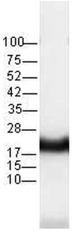 MilliporeSigma anti-Pan-Ras Clone: RAS 10, 100&mu;g, Unlabeled:Antibodies,
