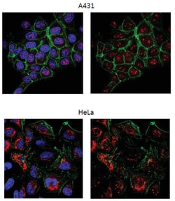 MilliporeSigma anti-Rad51 (Ab-1), Polyclonal 100&mu;L, Unlabeled:Antibodies,