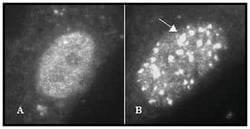 MilliporeSigma anti-hMre-11, Polyclonal 100&mu;g, Unlabeled:Antibodies,