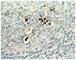 MilliporeSigma&trade;&nbsp;ApopTag&trade; Peroxidase In Situ Oligo Ligation (ISOL) Kit