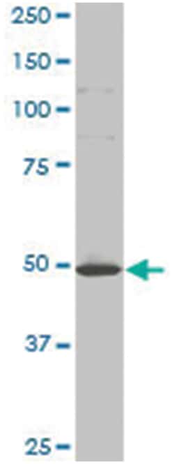 MilliporeSigma anti-HTT Clone: 3F1, 100&mu;g, Unlabeled:Antibodies, Monoclonal