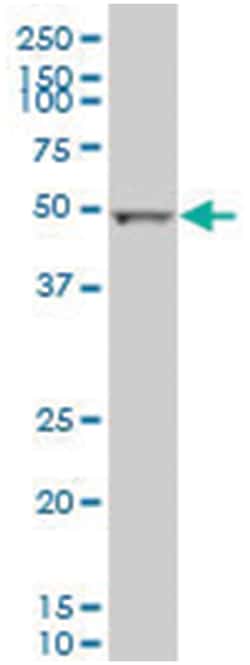 MilliporeSigma anti-ALDH2 Clone: 100000, 100 &mu;g | Buy Online | MilliporeSigma&trade; | Fisher Scientific