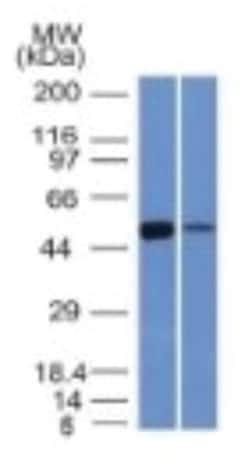 Aldehyde Dehydrogenase 1-A1/ALDH1A1 Antibody (ALDH1A1/1381) - Azide and