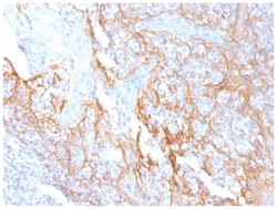 beta-Catenin Antibody (15B8) - Azide and BSA Free, Novus Biologicals:Antibodies:Primary