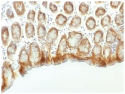 beta-Catenin Antibody (CTNNB1/1507), Novus Biologicals:Antibodies:Primary