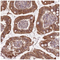 Fucosyltransferase 3/FUT3 Antibody, Novus Biologicals:Antibodies:Primary
