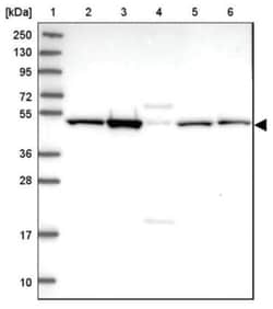 Brp16 Antibody, Novus Biologicals 100&mu;L; Unlabeled:Antibodies, Polyclonal