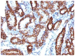 Cadherin-16 Antibody (CDH16/1532R) - Azide and BSA Free, Novus Biologicals:Antibodies:Primary