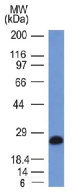 CD79A Antibody (IGA/1406), Novus Biologicals 200&mu;g; Unlabeled:Antibodies,