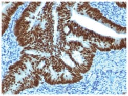 CDX2 Antibody (CDX2/1690), Novus Biologicals 100&mu;g; Unlabeled:Antibodies,