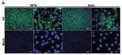 Chikungunya Virus Antibody (3E7b), Novus Biologicals:Antibodies:Primary