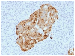 Chromogranin A Antibody (CHGA/1731R) - Azide and BSA Free, Novus Biologicals:Antibodies:Primary