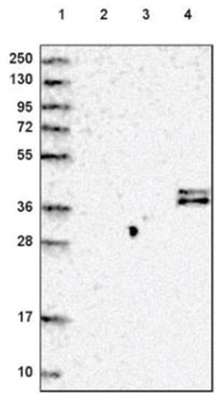 Complement Factor H-related 1/CFHR1/CFHL1 Antibody, Novus Biologicals 100&mu;L;