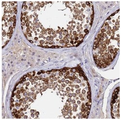 CT47A11 Antibody, Novus Biologicals 25 &mu;L:Antibodies, Polyclonal