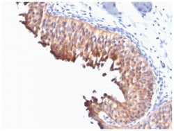 Cytokeratin 10 Antibody (DE-K10) - Azide and BSA Free, Novus Biologicals