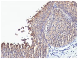Cytokeratin 10 Antibody (SPM623) - Azide and BSA Free, Novus Biologicals:Antibodies:Primary