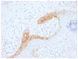 Cytokeratin 15 Antibody (KRT15/1699) - Azide and BSA Free, Novus Biologicals