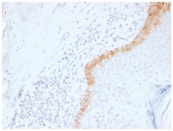 Cytokeratin 15 Antibody (LHK15), Novus Biologicals 20&mu;g; Unlabeled:Antibodies,