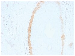 Cytokeratin 15 Antibody (SPM190), Novus Biologicals 100&mu;g; Unlabeled:Antibodies,