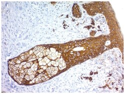 Cytokeratin, HMW Antibody (KRTH/1576R) - Azide and BSA Free, Novus Biologicals