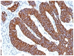 Cytokeratin 8/18 Antibody (KRT8.18/1346) - Azide and BSA Free, Novus Biologicals
