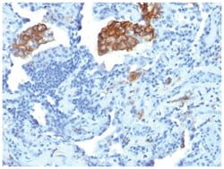 DC-SIGN/CD209 Antibody (C209/1781), Novus Biologicals:Antibodies:Primary