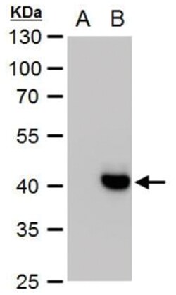 Dengue Virus NS1 protein Antibody, Novus Biologicals 0.1mL; Unlabeled:Antibodies,