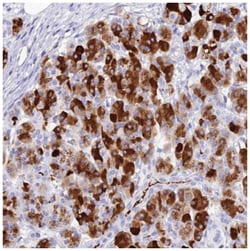 ELA3A Antibody, Novus Biologicals:Antibodies:Primary Antibodies