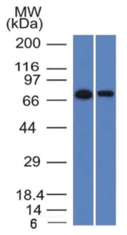 Endoglin/CD105 Antibody (ENG/1327) - Azide and BSA Free, Novus Biologicals:Antibodies:Primary