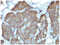 Enolase 2/Neuron-specific Enolase Antibody (SPM347), Novus Biologicals:Antibodies:Primary