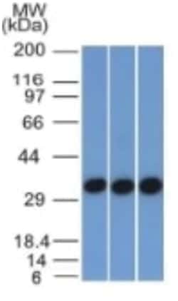 EpCAM/TROP1 Antibody (EGP40/1372) - (ECD) - Azide and BSA Free, Novus Biologicals
