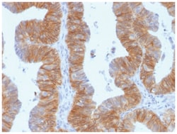 EpCAM/TROP1 Antibody (EGP40/1384) - (ECD), Novus Biologicals 200&mu;g;