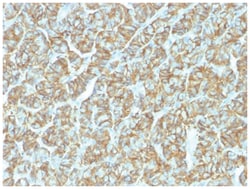 EpCAM/TROP1 Antibody (EGP40/1555R) - (ECD) - Azide and BSA Free, Novus