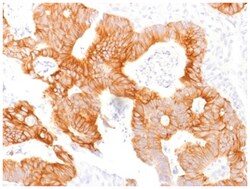 EpCAM/TROP1 Antibody (EGP40/1798) - (ECD) - Azide and BSA Free, Novus Biologicals