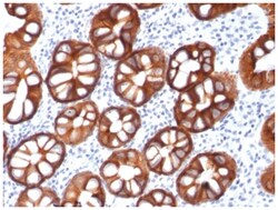 EpCAM/TROP1 Antibody (rMOC-31) - Azide and BSA Free, Novus Biologicals:Antibodies:Primary