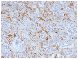 Ferritin Light Chain Antibody (FTL/1388) - Azide and BSA Free, Novus Biologicals 200 &mu;g | Buy Online | Novus Biologicals | Fisher Scientific