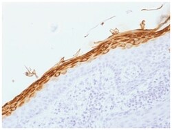 Filaggrin Antibody (FLG/1562) - Azide and BSA Free, Novus Biologicals:Antibodies:Primary